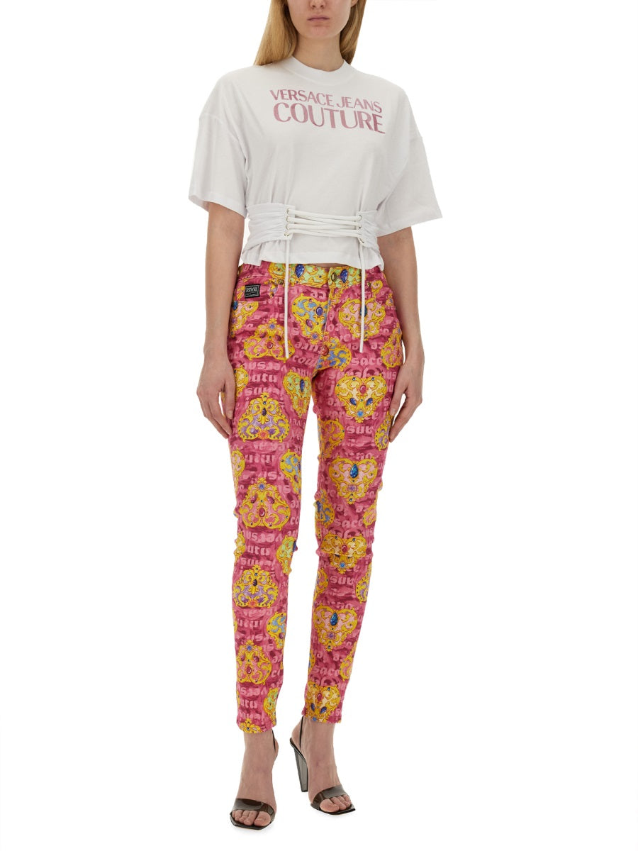 SKINNY FIT JEANS